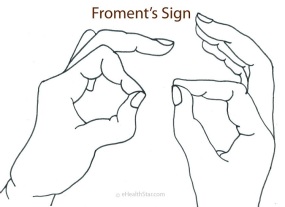 Froments-Sign-Pictures-1